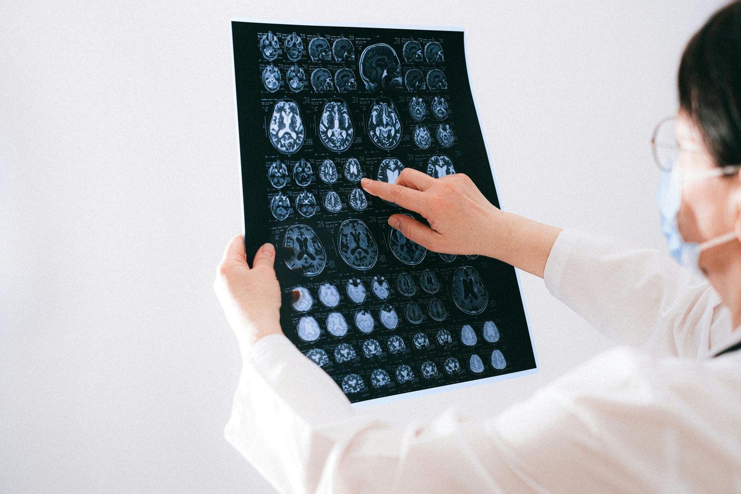 Eine Ärztin zeigt mit dem Finger auf einen Gehirnscan