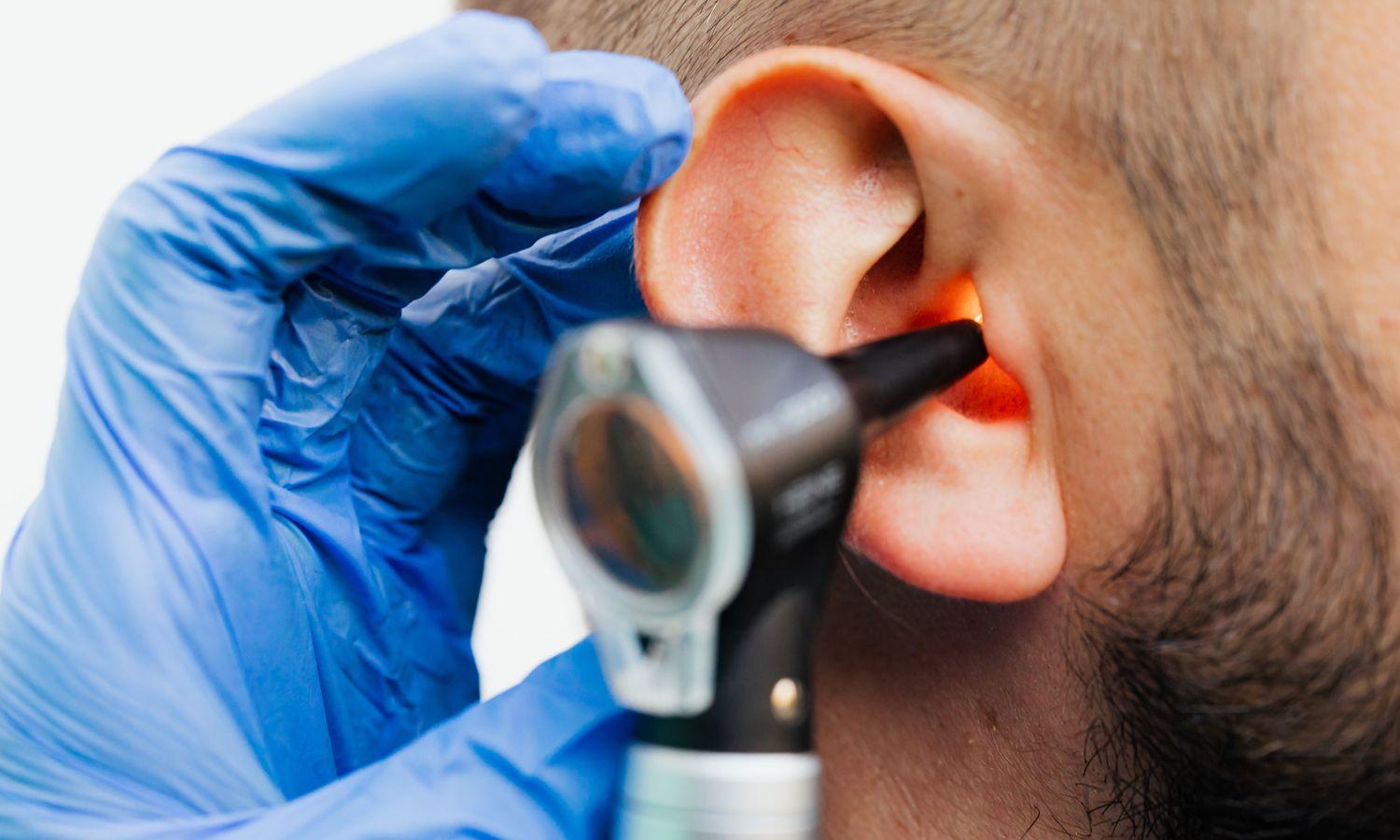 Nahaufnahme vom Ohr eines Mannes, der im Zuge einer Tinnitus-Behandlung mit einem Otoskop untersucht wird.